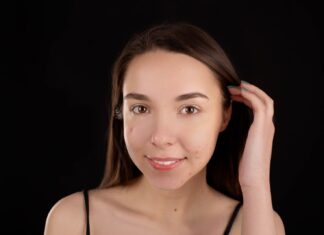 Bệnh Mụn Trứng Cá