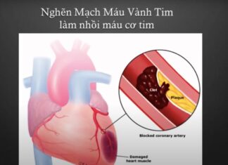 Mỡ máu cao (Cholesterol) với Bác Sĩ John Hậu Liên, phần 1