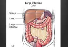 Ung thư ruột già (Colon Cancer) – Dr. Huy Trinh, MD