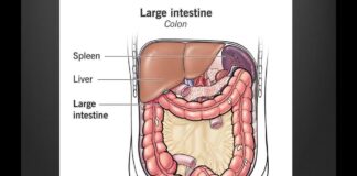 Ung thư ruột già (Colon Cancer) – Dr. Huy Trinh, MD